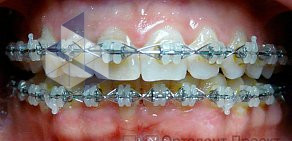 Стоматологическая клиника Ортодонт-Проект Ольги Барановой