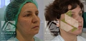 Клиника молодости и красоты СЛ на улице Адоратского