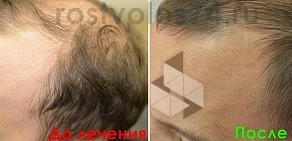 Интернет-магазин препаратов для волос Рост волос
