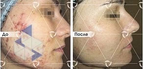Клиника лазерной косметологии Линлайн на улице Кирова