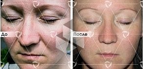 Клиника лазерной косметологии Линлайн на улице Кирова