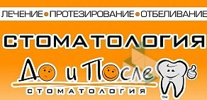 Стоматологическая клиника До и После