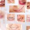 Студия косметического экспресс отбеливания зубов White & Smile39