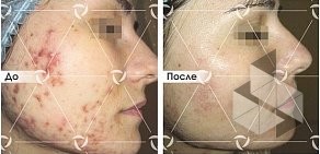 Клиника лазерной косметологии ЛИНЛАЙН в Ленинском районе