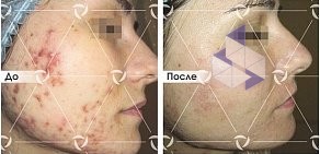 Клиника лазерной косметологии ЛИНЛАЙН на Беленца