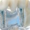 Стоматологическая клиника 33-й Зуб на проспекте Просвещения