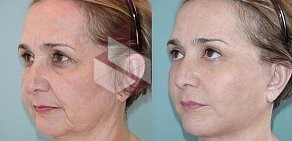 Клиника косметологии и лазерной эпиляции SkinLaser на метро Комсомольская