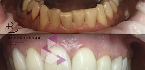 Стоматология Реставрация на Марксистской улице