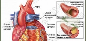 Кардиоцентр на Кашириных