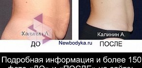 Студия коррекции фигуры Newbodyka на метро Речной вокзал