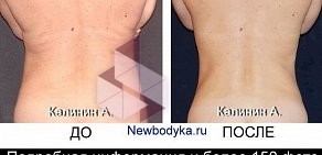 Студия коррекции фигуры Newbodyka на метро Речной вокзал