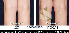 Студия коррекции фигуры Newbodyka на метро Речной вокзал