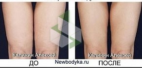 Студия коррекции фигуры Newbodyka на метро Речной вокзал