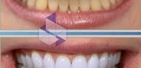 Кабинет косметического отбеливания зубов White & Smile