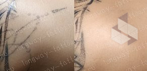 longway tattoo & laser