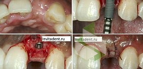 Стоматологический центр InVitaDent в Балашихе 