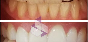 Студия косметического отбеливания зубов и наращивания ресниц VIPsmile