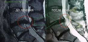 Клиника лечения позвоночника и суставов Доктора Длина на метро Новые Черёмушки