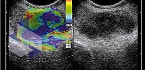 Группа компаний СМТ официальное представительство фирмы PENTAX MEDICAL