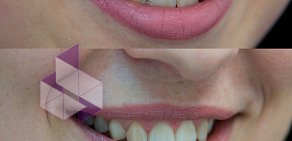 Студия по отбеливанию зубов White & Smile