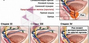 Международный Центр Профилактики Онкологических Заболеваний на проспекте Энгельса