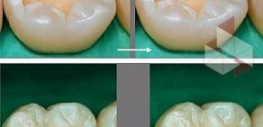 Стоматологическая клиника Дента люкс